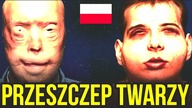 10 WIELKICH POLSKICH POSTEPOW W MEDYCYNIE