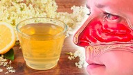 5 Naturalnych Sposobów Leczenia Alergii