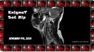 Allex - Endurance (Cut From Clay Set)