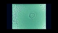 Robaki zębowe - najważniejszy mit w dziejach stomatologii (AKRK 011)