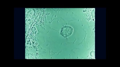 Robaki zębowe - najważniejszy mit w dziejach stomatologii (AKRK 011)