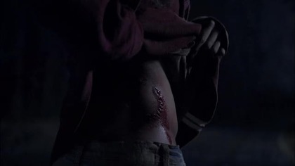 Teen Wolf S01E07