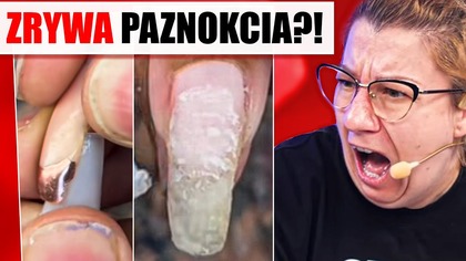 Poprawna TECHNIKA ZRYWANIA PAZNOKCI ISTNIEJE? | QULOO LUPA
