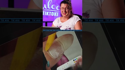 NARAZIŁA KLIENTKĘ NA ZIELONĄ BAKTERIĘ