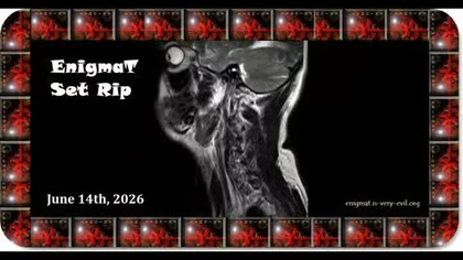 Fejka, polaroit, & Kingship - Flicker (Cut From end. ways Set)-enTc