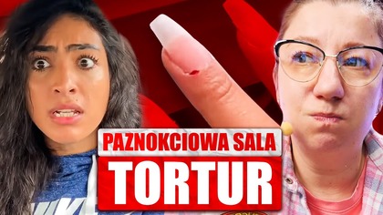 NAGRYWANIE, WAŻNIEJSZE OD ZDROWIA? | PAZNOKCIOWE CASE STUDY