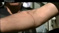 Człowiek kt&oacute;ry nie czuje b&oacute;lu Discovery Channel "Supermocni''.  Dokument