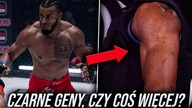 Czarne Geny Czy Coś Więcej? | Alberto Simao