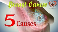 Breast Cancer - 5 Causes.