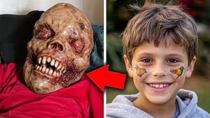 10 Odważnych Ludzi, Którzy Przetrwali Niemożliwe