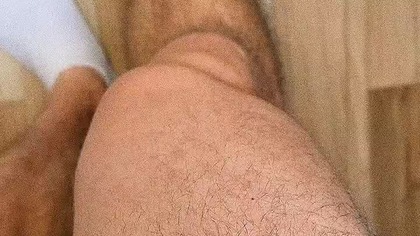 Noga jak salceson #shorts