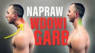 WDOWI GARB i WYSUNIĘTA GŁOWA - Napraw To!