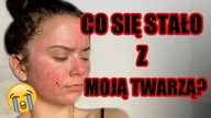Co zrobiłam z twarzą?