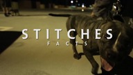 Stitches- Facts