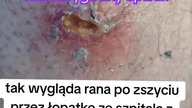 Marcel łopatka lekarz sor-u który prześladował mi 3,5 godziny i nie szczuł rany w Cieszynie