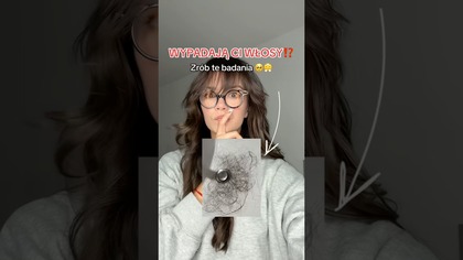 WYPADAJĄ CI WŁOSY?!  ZRÓB TE BADANIA! #wypadaniewłosów #haircare