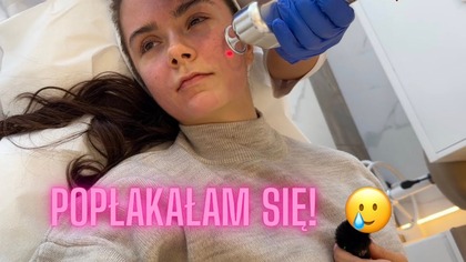 Bałam się tego zabiegu co się stało?! | COMFRT VLOG