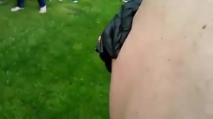 Monstrualny pryszcz !!!