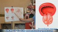 Leczenie Prostaty- Skuteczność 99%.  Aliaksandr Haretski.