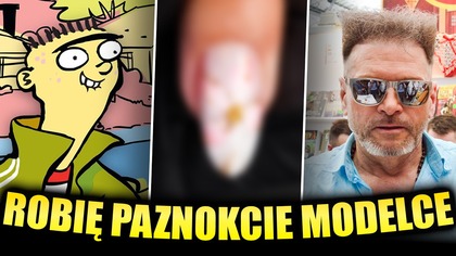 CO ŁĄCZY ED, PAZNOKCIE I KRZYSZTOFA RUTKOWSKIEGO?