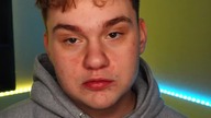 BIONICZNE Protezy - Lepsze od CIAŁA?! #ciekawostki #wynalazki #hype