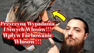 1812.  Przyczyna Wypadania I Siwych Włos&oacute;w !!! Wpływ Farbowania Włos&oacute;w !!!