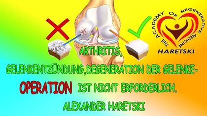 Arthritis, Gelenkentzündung, Degeneration Der Gelenke Operation Ist Nicht Erforderlich Haretski