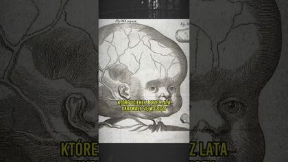 Melonowe Głowy - Potwory z Miejskich Legend