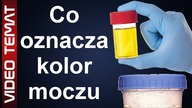 Co oznacza kolor moczu