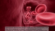 Ta przyprawa uchroni Cię przed ŚMIERTELNĄ chorobą, która długo nie daje objawów