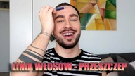 PRZESZCZEP WŁOSÓW - od czego zależy LINIA WŁOSÓW ?  CiaRo UsaGo :D