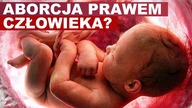 Michalkiewicz o chorobie czerwonych oczu