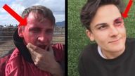 NAJGORSZE RANY otrzymane przez YOUTUBERÓW! 2