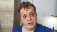 Jak sobie poradzić z Akcyzą ?