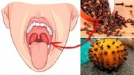 10 NIESAMOWITYCH KORZYŚCI ZDROWOTNYCH TEJ PRZYPRAWY | GOŹDZIKI