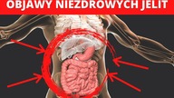 Nietypowe objawy problemów z jelitami z JELITAMI - Nie lekceważ ich!