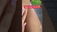NIGDY nie nakładaj samoopalacza! dlatego