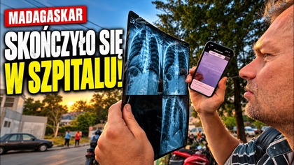 Upadek na moto, wizyta wszpitalu - Tour de Madagascar - E31 [ENG SUB]