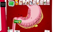 Amateur Surgeon - przewodnik po grze (PC)