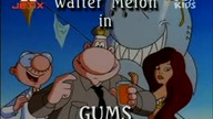 Walter Melon - Zęby