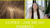 ŁUPIEZ JAK POZBYC SIE TEJ CHOROBY? SPRAWDZONE SPOSOBY